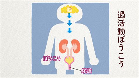 「笑った瞬間に…」若い女性の「尿もれ」の悩み、専。